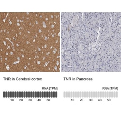 Tenascin R Antibody, Novus Biologicals 0.1mL; Unlabeled:Antibodies, Polyclonal